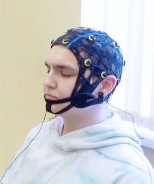 Электроэнцефалография